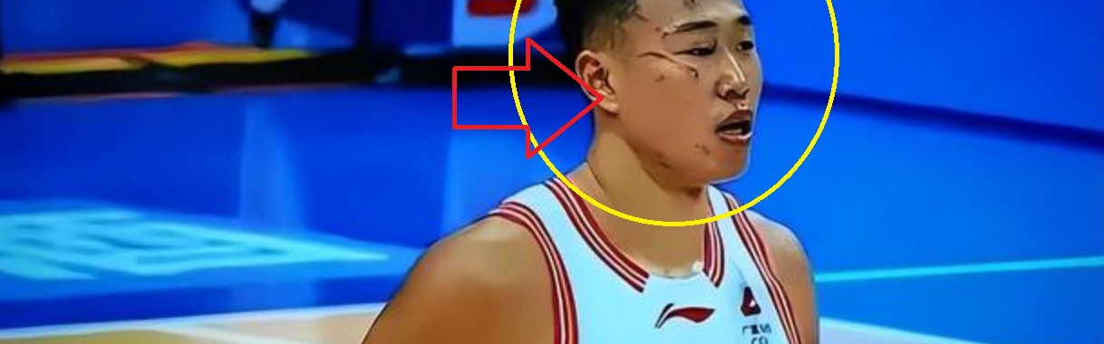 开云官网-可怜！一只手防守，一只手护自己的脸 球迷：CBA太可怕了